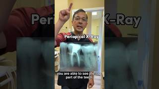 How to Take PERFECT Dental XRays Periapical  In Office to Hands On Dental Training shorts [upl. by Zins164]