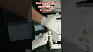 western blot membrane transfer [upl. by Nnaecarg681]