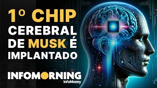 Elon Musk anuncia 1º implante de chip cerebral [upl. by Sinnylg]