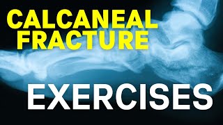 Calcaneal Fracture Exercises [upl. by Lesig]