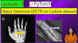 L7  DETR  Object detection Using Detection Transformer on custom dataset [upl. by Ahsil]