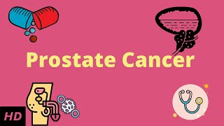 Prostrate Cancer Causes Signs and Symptoms DIagnosis and Treatment [upl. by Tebazile625]