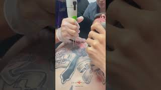 🖋️ Inks isnt forever Laser Tattoo Removal 👍 ⚡ [upl. by Nosreffej787]