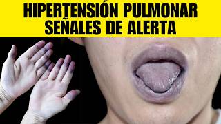 9 Signos Extraños de Hipertensión Arterial Pulmonar que Debes Conocer [upl. by Ynnav534]