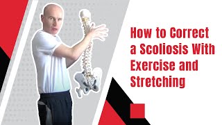 How to Correct a Scoliosis With Exercise and Stretching  Edward Paget [upl. by Akcinehs]