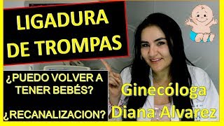 LIGADURA DE TROMPAS ¿PUEDO VOLVER A EMBARAZARME POR GINECOLOGA DIANA ALVAREZ [upl. by Dre]