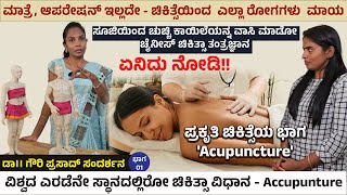 ಮಾತ್ರೆ ಆಪರೇಷನ್ ಇಲ್ಲದೇ Acupuncture ಚಿಕಿತ್ಸೆಯಿಂದ ಎಲ್ಲಾ ರೋಗಗಳು ಮಾಯ Rishi Acupuncture Treatment1 [upl. by Clive]