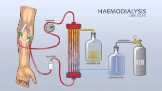 HAEMODIALYSIS DIALYZER [upl. by Jaunita425]