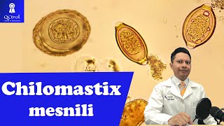 Conoce a Chilomastix mesnili morfología y CLAVES para su identificación🔬 [upl. by Donegan952]