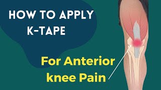 How to apply Kinesiology tape for knee pain  Patella Femoral Syndrome  Osgood Schlatters Syndrome [upl. by Philan228]