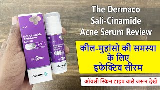 Serum for Acne Pimples  The Dermaco Sali Cinamide AntiAcne Serum Review [upl. by Lakim517]