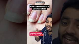 Doctor reacts Biotin deficiency 🤯 check description shorts drfaem [upl. by Nauqahs496]