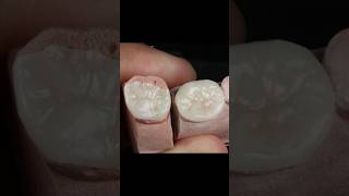 Maquillaje Disilicato de Litio aidite dientes esteticadental [upl. by Baynebridge]