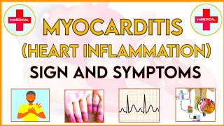 Myocarditis causes pathogenesissign and symptoms diagnosis and treatment [upl. by Annasus]