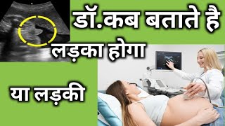 Baby kicks During 789th Month PregnancyPart14 देखिये शिशु गर्भ में कैसे घूमता हैkicks [upl. by Sorenson]