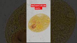 Balantidium coli en él laboratorio clínico [upl. by Niwre]