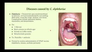 Corynebacterium diphtheriae Diphtheria  Microbiology Boot Camp [upl. by Henrietta]