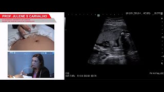 Live Fetal Heart Ultrasound with Prof Julene Carvalho  assessment and cardiac function analysis [upl. by Armbrecht]