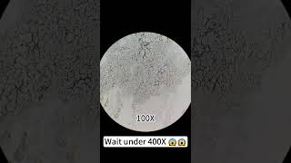 Pimples at 400X magnification are really cool underthemicroscope beefcut scienceshorts [upl. by Enert]