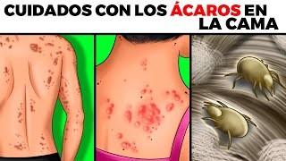 ÁCAROS EN LA CAMA alergias peligros cómo se mira en tu piel cómo eliminarlos y prevenirlos [upl. by Stamata]