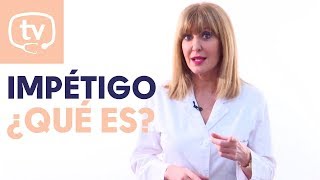 Impétigo una infección bacteriana [upl. by Ettennyl]