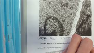 IB Biology Magnification exam questions made easy [upl. by Darrill]