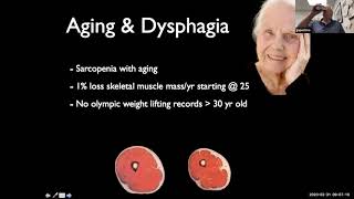 Dysphagia amp Transnasal Esophagoscopy I  Dr Gregory Postma [upl. by Tobias]