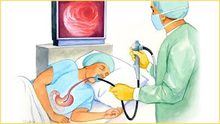 Endoscopic Procedure  Indications Types How It Is Done Risks And Complications [upl. by Acila]