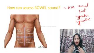 How to Assess BOWEL SOUNDProcedure of bowel Sound assessment AUSCULTATION OF ABDOMEN BORBORYGMUS [upl. by Akirehs493]