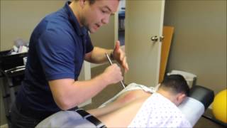 Graston  Chiropractor White Mountain Chiropractic amp Rehabilitation [upl. by Suirtemid72]