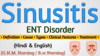 Sinusitis Sinusitis In Hindi Nursing Lecture [upl. by Fabrienne]