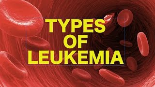 Leukemia  USMLE [upl. by Canon]