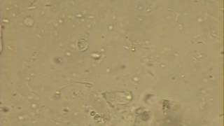 Giardia Trophozoite Looped [upl. by Manvell]