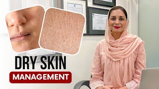 How to Manage Dry Skin [upl. by Altman]