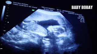 SEEING BABY BOBAY  Ultrasound Visit [upl. by Reisinger]