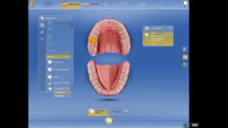 CEREC Dental Assistant Training  Basic Setup for CrownBridge [upl. by Neros]