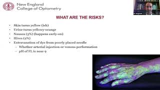 Lecture Fluorescein Angiography [upl. by Naget]