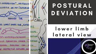 POSTURAL DEVIATION LATERAL VIEW LOWERE LIMB Posture BiomechanicsPhysiotherapy Tutorial [upl. by Leterg]