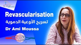 Chirurgie Vasculaire  Revascularisation avec le Dr Ami Moussa  تسريح الأوعية الدموية [upl. by Allicserp608]