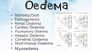 Oedema Pathology [upl. by Raynard356]