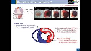 Quantitative 3D Assessment of Myocardial IschemiaReperfusion Injury and Response [upl. by Akcir96]