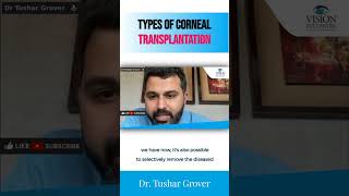 Types of Corneal Transplantation  Dr Tushar Grover [upl. by Aneg930]