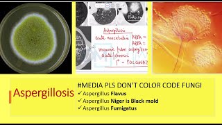 Yellow fungus  Aspergillus Flavus  Aspergillosis by Dr Marwah [upl. by Nivahb]