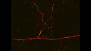 Arbuscular Mycorrhizal Symbiosis extraradical lipid flow 1 Live Imaging [upl. by Pathe]