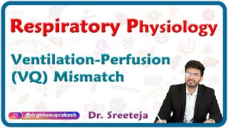 Ventilationperfusion VQ mismatch  Respiratory physiology USMLE Step 1 [upl. by Aratihc]