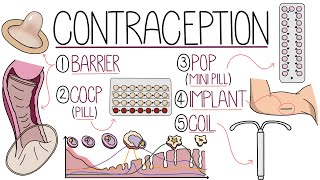 Methods of Contraception Made Easy Contraceptive Methods Explained [upl. by Shannon]