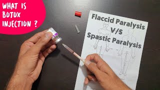 Spastic and Flaccid Paralysis  What is Botox Injection  The Charsi of Medical Literature [upl. by Ahsekan620]