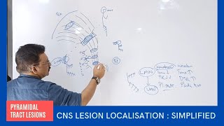 CNS Lesion Localisation at your Finger Tips by Dr Gireesh Kumar KP  Simplified Version [upl. by Eimam]