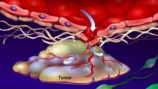 Introduction to Cancer Biology Part 4 Angiogenesis [upl. by Lili]