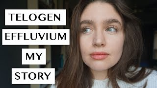 TELOGEN EFFLUVIUM  MY RECOVERY STORY  LAUREN NEWLY [upl. by Yhtnomit]